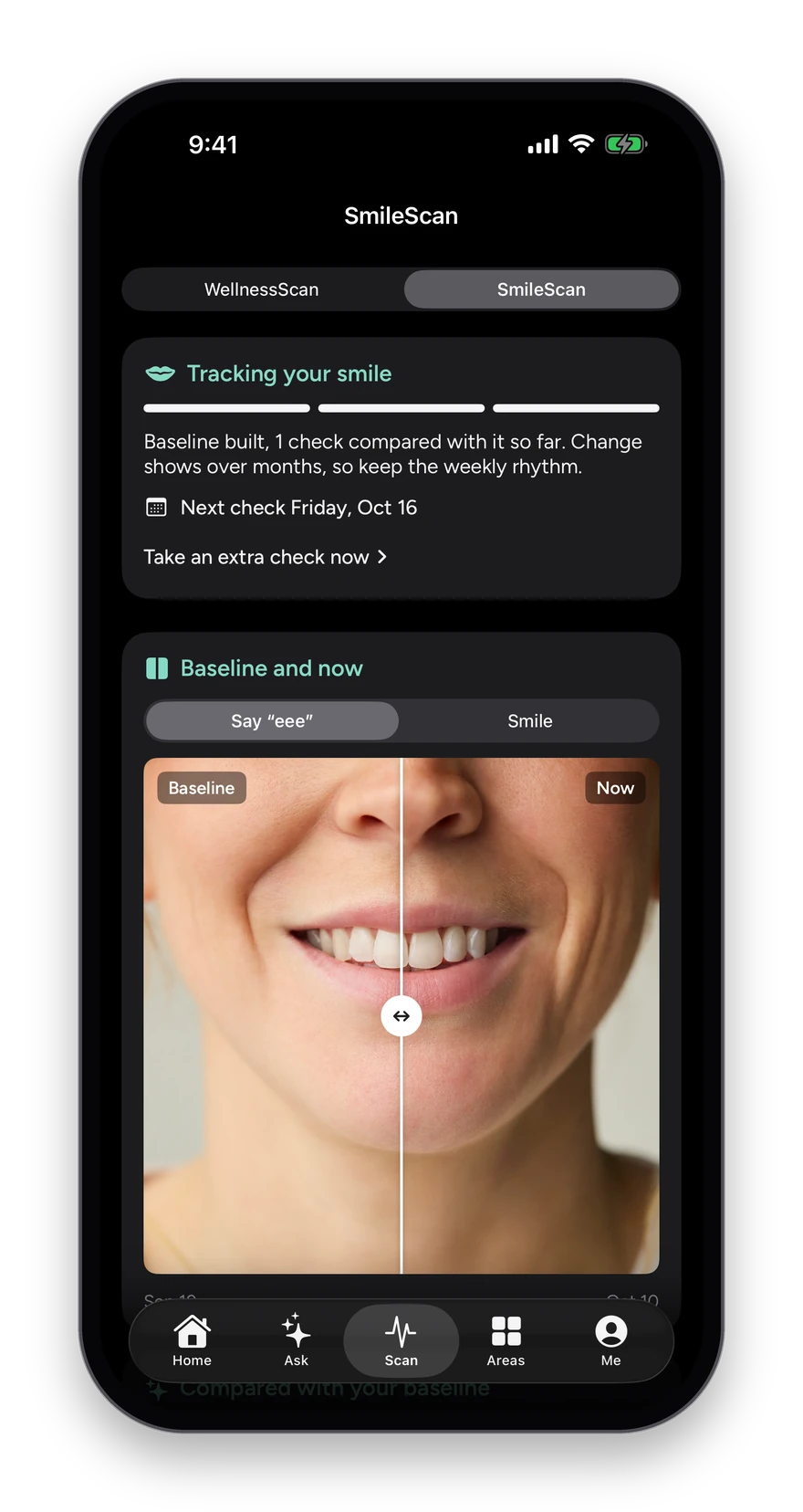 The SmileScan: WellnessScan and SmileScan side by side at the top, the baseline built, and a baseline and this week's photo split by a slider.