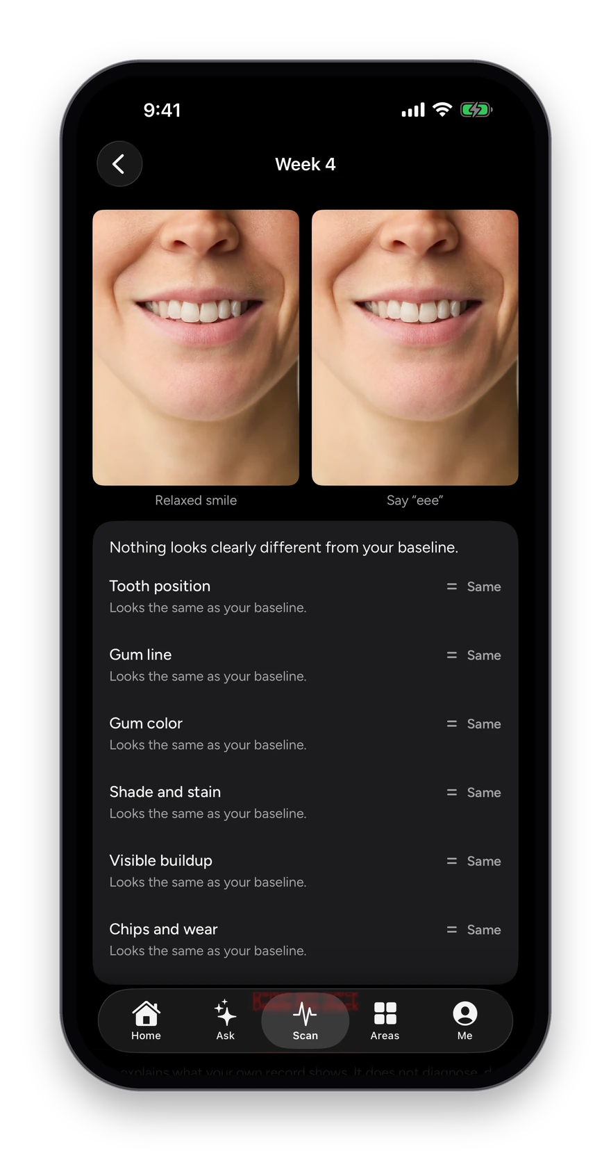 A weekly SmileScan compared with the baseline: tooth position, gum line, gum color, shade, buildup and wear, each reading the same.